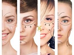 Chirurgie visage Turquie
